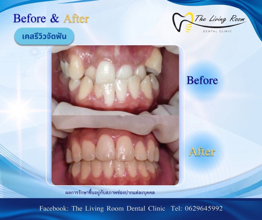 Orthodontics 1