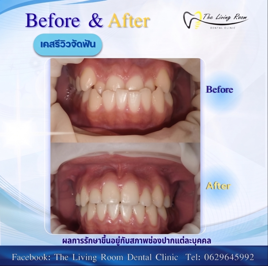 Orthodontics 2